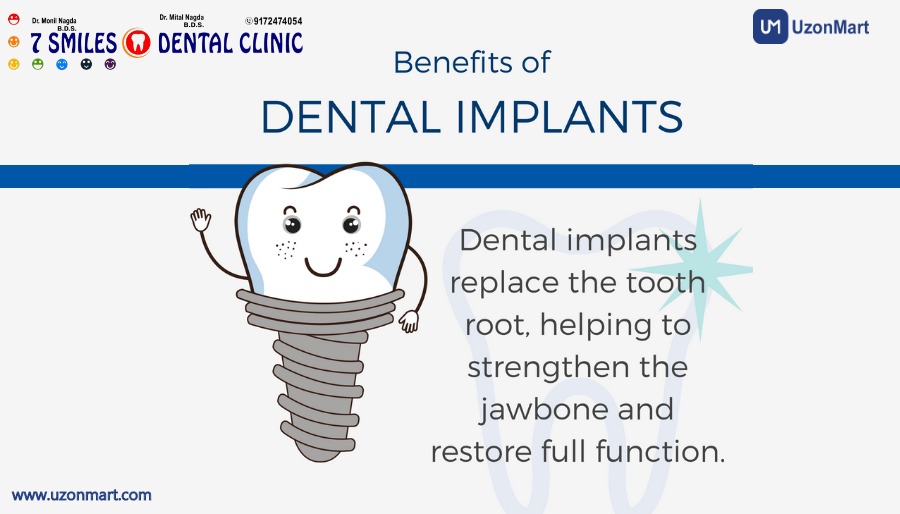 Dental Implants in Mulund