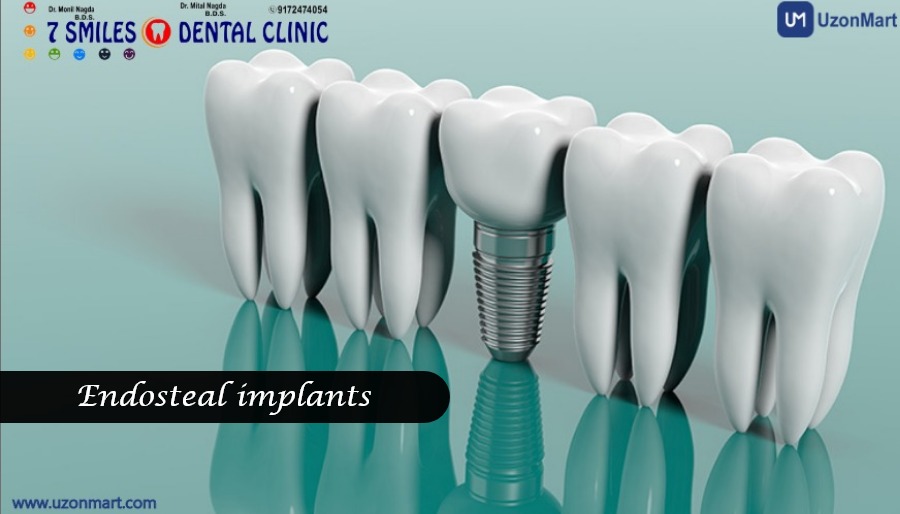 Dental Implants in Mulund