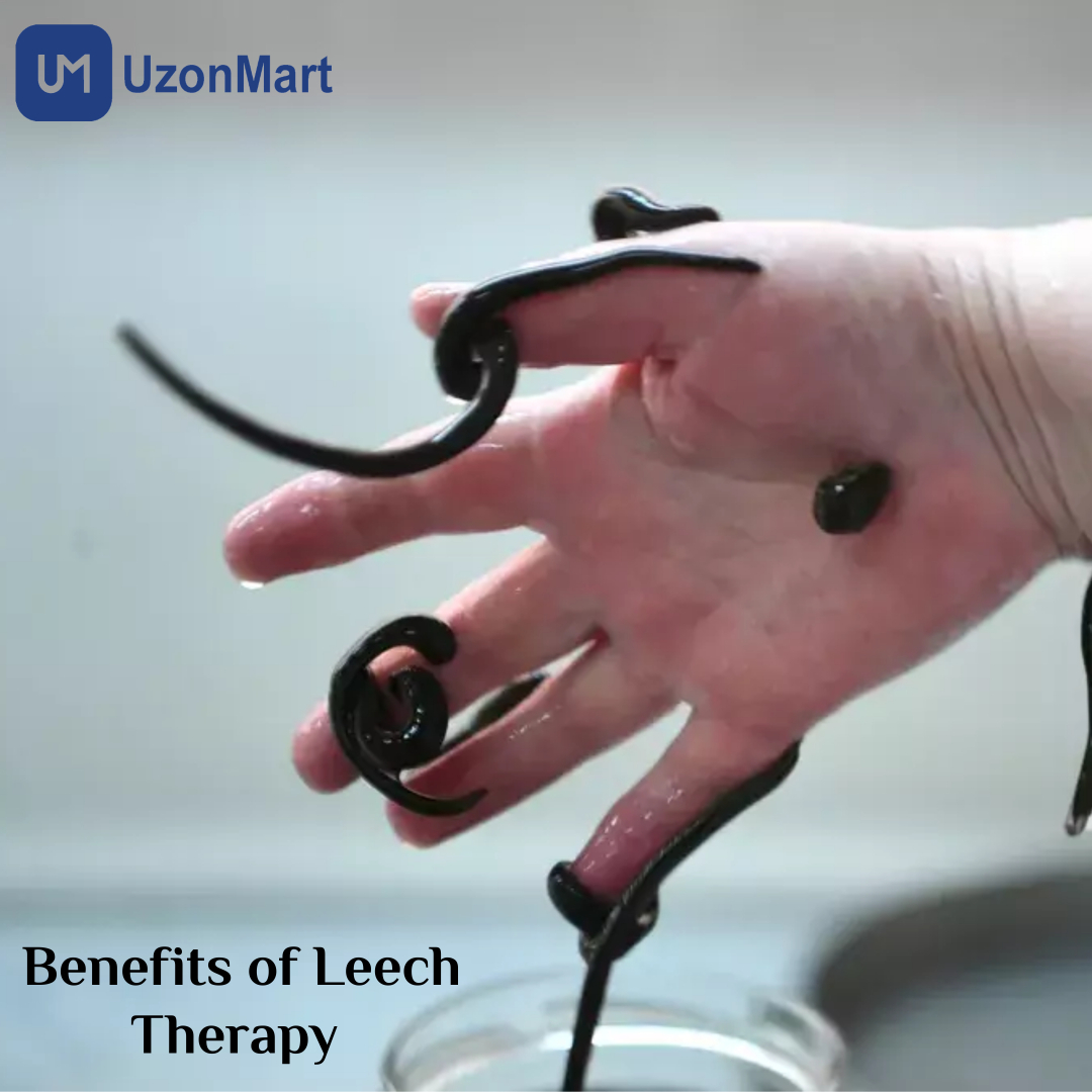 Leech Therapy in Mumbai