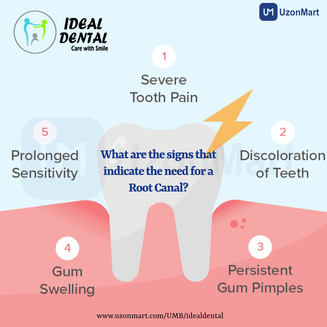  Root Canal Treatment in Thane 