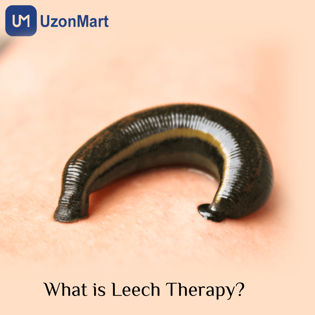 Leech Therapy in Mumbai