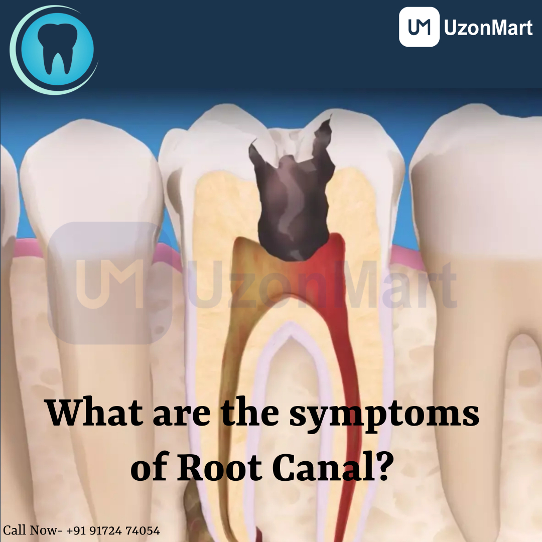 Root Canal Treatment in Mulund