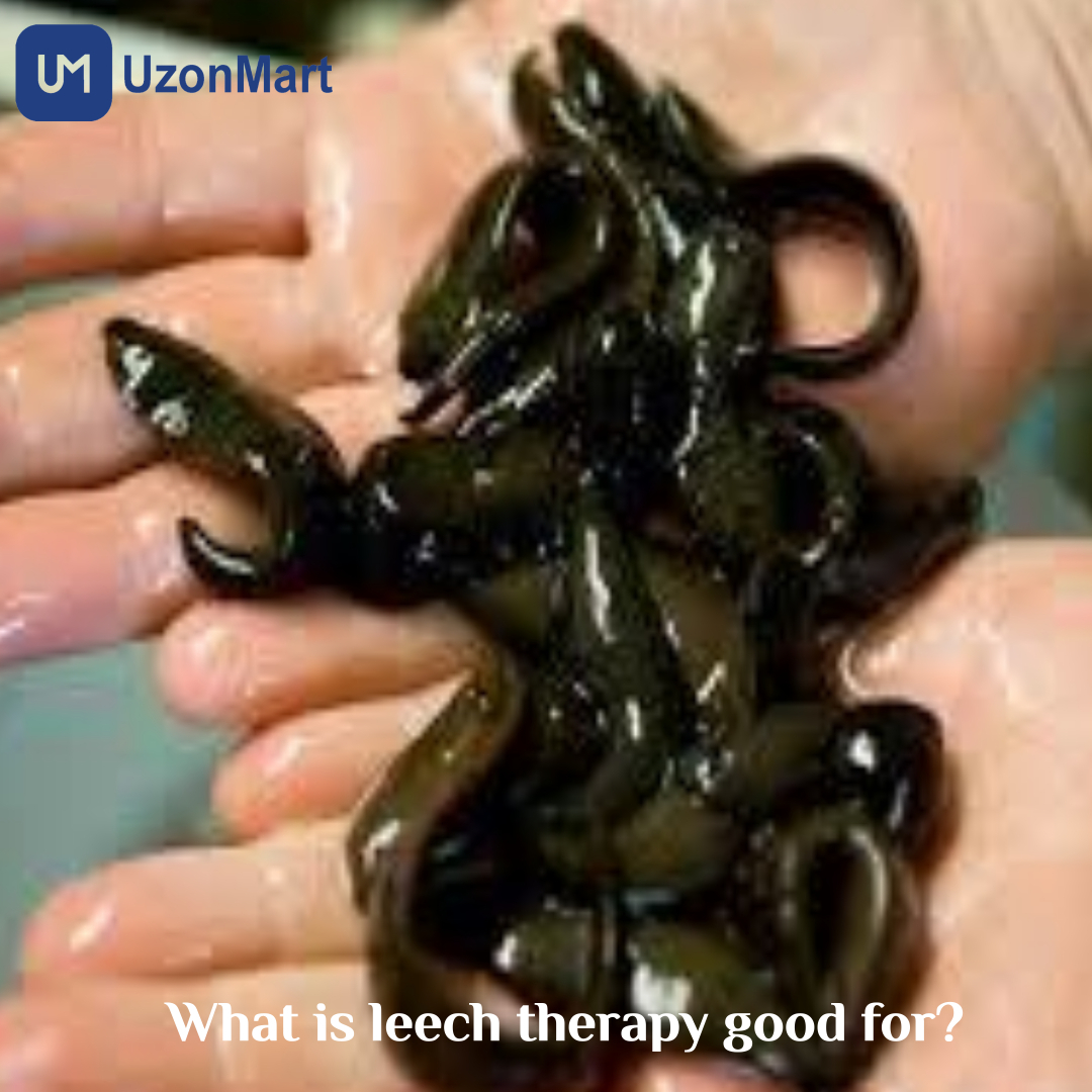 Leech Therapy in Mumbai