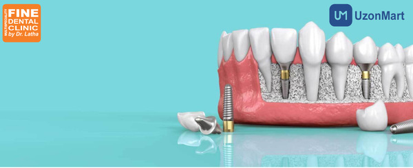 Best Dental Clinics in Mumbai