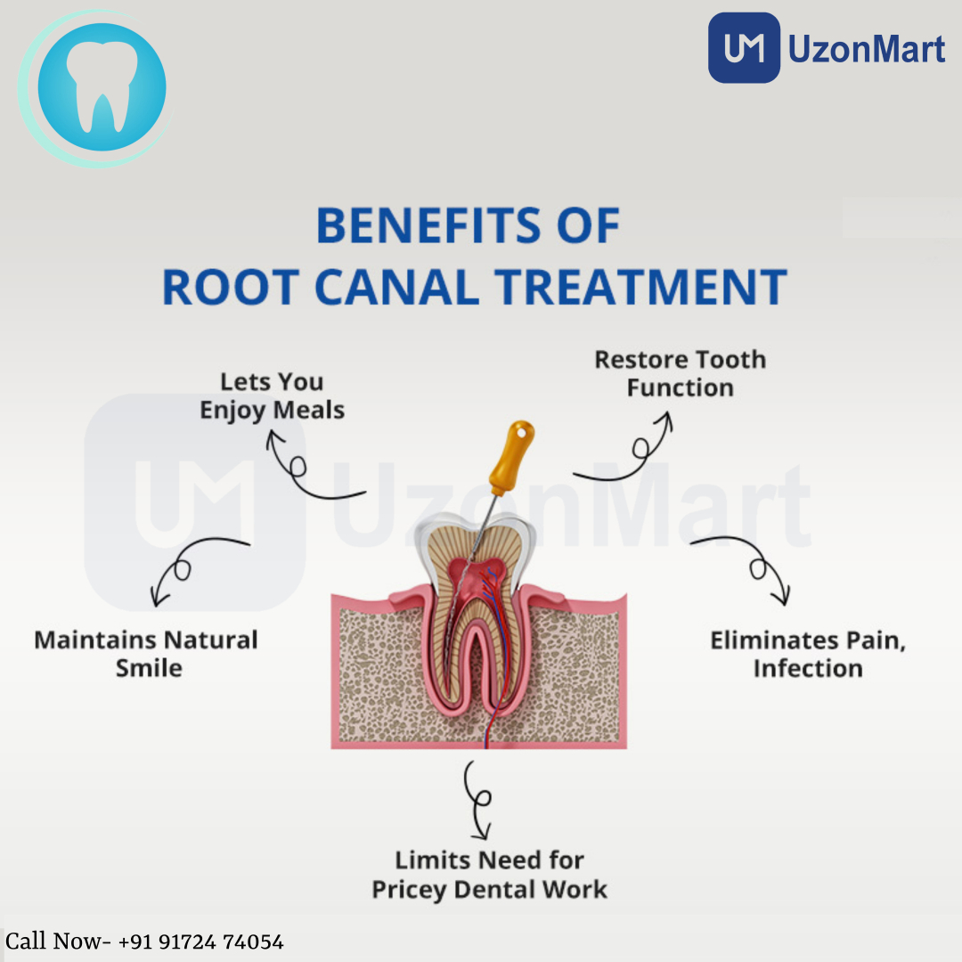 Root Canal Treatment in Mulund